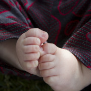 Hair Tourniquet Puts Baby's Toes At Risk