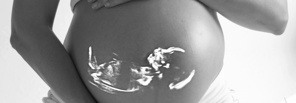 Radiation Pregnant Birth Defect