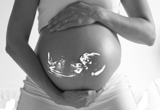 Radiation Pregnant Birth Defect