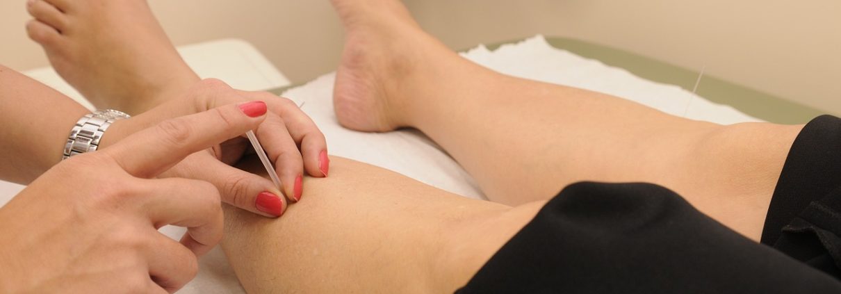 Acupuncture and Fertility