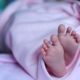 Fetal Stroke Birth Injury