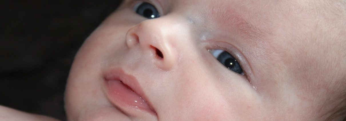 Horner's Syndrome Birth Injury Lawyer