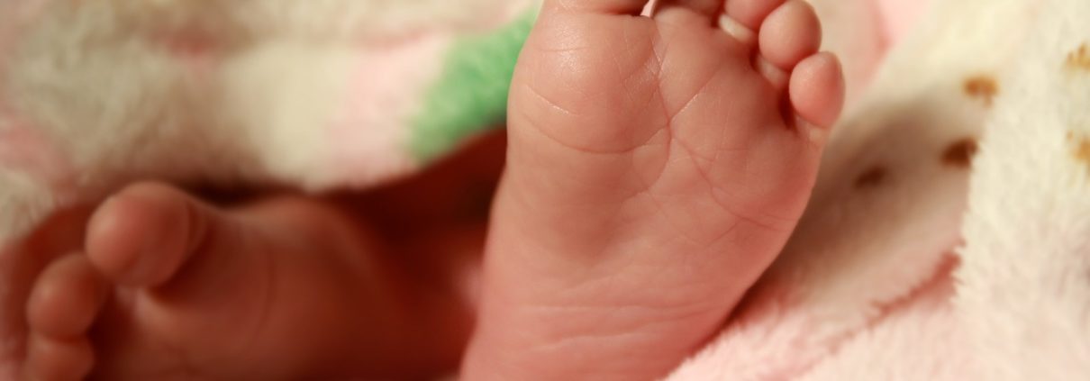 Dystonia Disorder Cerebral Palsy Birth Injury